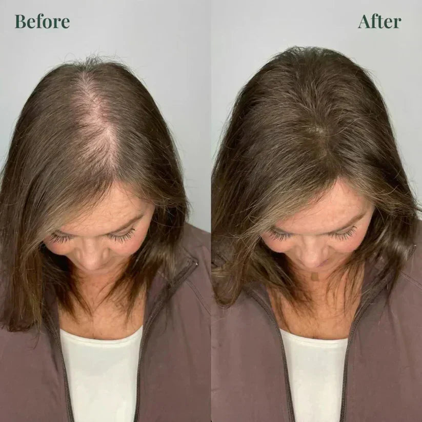 Kerarose Rosemary Shampoo For Hair Growth (Buy 1 Get 1 Free 🔥🔥)